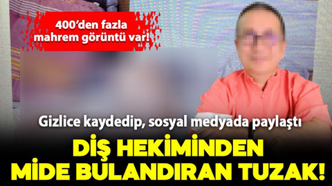 Diş hekiminden mide bulandıran gizli kamera tuzağı: 400'den fazla mahrem görüntü var!