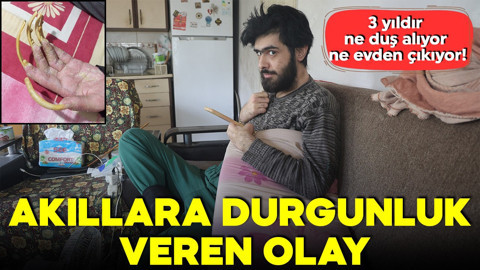 Akıllara durgunluk veren olay! 3 yıldır ne duş alıyor ne evden çıkıyor