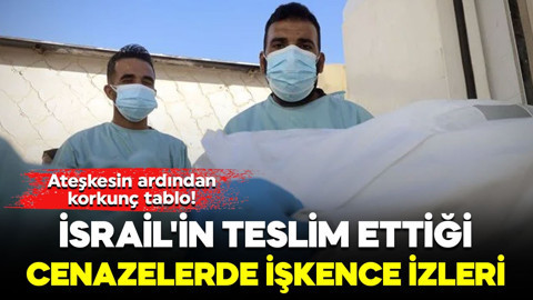 Ateşkesin ardından korkunç tablo! İsrail'in teslim ettiği cenazelerde işkence izleri