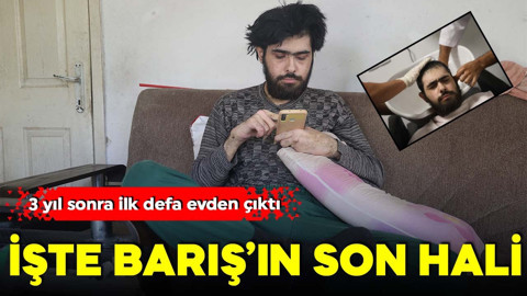 3 yıl sonra ilk defa evden çıktı: İşte Barış'ın son hali