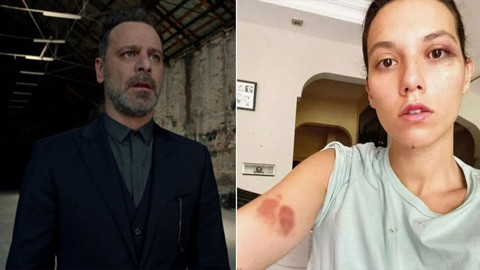 Eski sevgilisi Deniz Bulutsuz'u darp etmişti! Ozan Güven'e hapis şoku