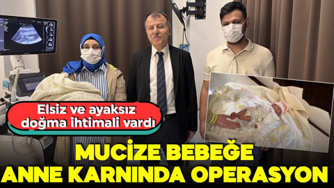 Elsiz ve ayaksız doğma ihtimali vardı! Mucize bebeğe anne karnında operasyon!
