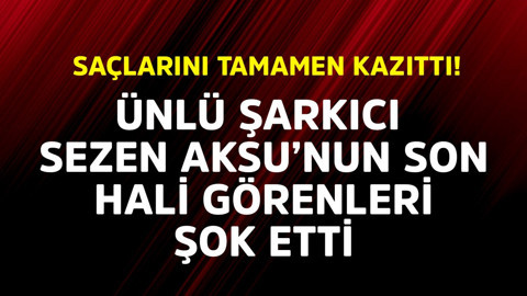 Ünlü şarkıcı Sezen Aksu'nun son hali görenleri şok etti! Saçlarını tamamen kazıttı
