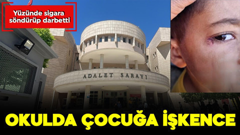 Okulda çocuğa işkence! Yüzünde sigara söndürüp darbetti