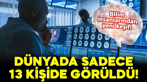 Bilim insanlarından yeni keşif: Dünyada sadece 13 kişide görüldü!