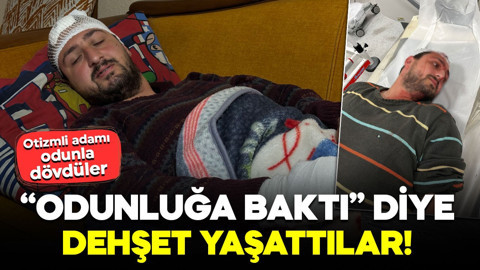Vicdanları sızlatan olay! “Odunluğa baktı” diye dehşet yaşattılar: Otizmli adamı odunla dövdüler