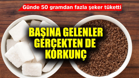 Günde 50 gramdan fazla şeker tüketti! Başına gelenler korkunç
