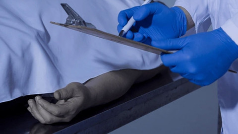 Korkunç gerçek otopside ortaya çıktı! Tatilde ölen adamın kalbi çalındı