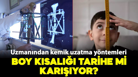 Boy kısalığı tarihe mi karışıyor? Uzmanından kemik uzatma yöntemleri