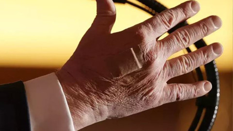 Trump hasta mı? Günlerdir böyle geziyor! Görüntüler çoğaldı, sosyal medya karıştı!