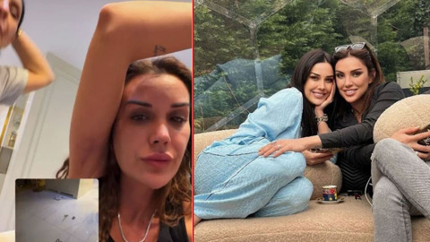 Dilan Polat, kardeşi Sıla Doğu'dan tekme tokat dayak yedi! Saçlarını kopardı, kollarını morarttı