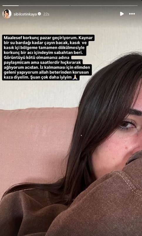 Oyuncu Şükrü Özyıldız'ın sevgilisinden üzücü haber! Korkunç acılar içinde kaldı, vücudu yandı - Resim: 4