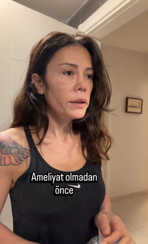 Yüz nakli operasyonu geçiren Didem Ceran'ın son hali olay oldu: "Bebeksiyim, yapay zeka değil" - Resim: 2