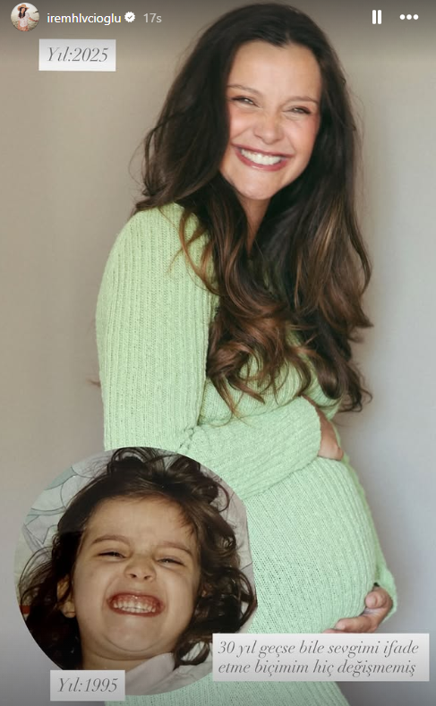 İrem Helvacıoğlu çocukluk fotoğrafını paylaştı! “30 yıl geçse bile hiç değişmemiş" - Resim: 5