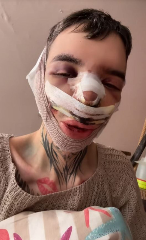 Sosyal medyada "Tablet Reis" olarak tanınıyordu! Ünlü fenomen 5 ayrı yüz ameliyatı oldu, son hali görenleri şoke etti - Resim: 6