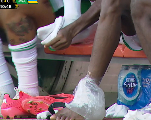 Victor Osimhen'den Galatasaray'a kötü haber! Son hali korkuttu - Resim : 1