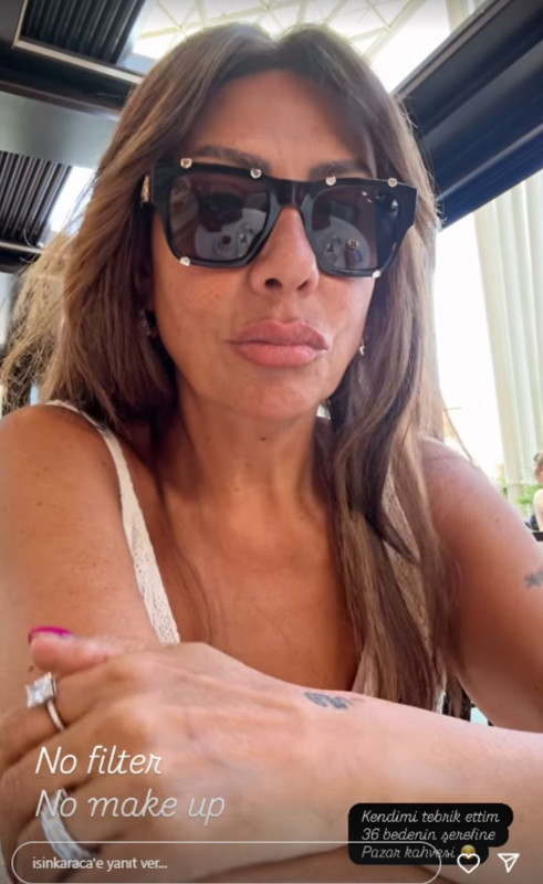 4 ayda 24 kilo vermişti! İğne ipliğe dönen Işın Karaca'dan "Filtresiz - makyajsız" paylaşım - Resim: 6