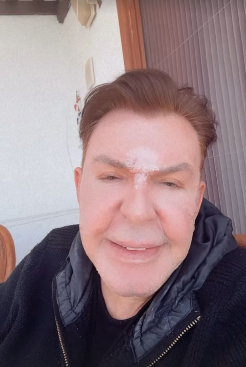 Yüz gerdirme operasyonu geçirmişti! Kuşum Aydın son halini paylaştı - Resim: 6