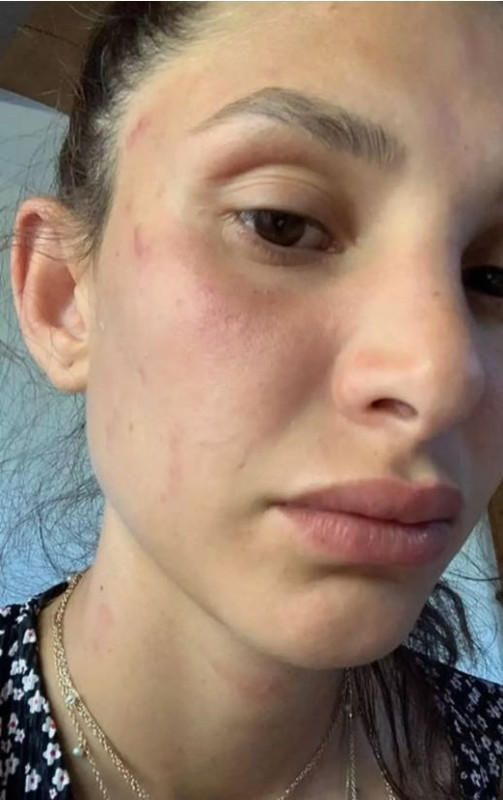Can Yaman'ın sevgilisi kanlar içinde paylaşımda bulundu! "Artık susmayacağım" diyerek uğradığı şiddeti anlattı - Resim: 7