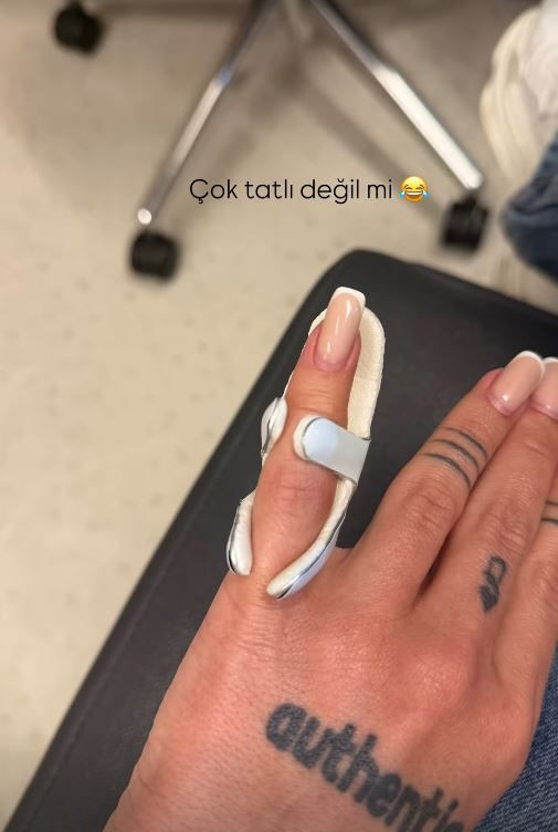 İrem Derici'nin parmağı yamuldu! Nedenini duyanlar şaştı kaldı - Resim: 4