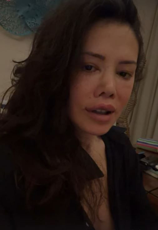 Yüz nakli operasyonu geçiren Didem Ceran'ın son hali olay oldu: "Bebeksiyim, yapay zeka değil" - Resim: 9