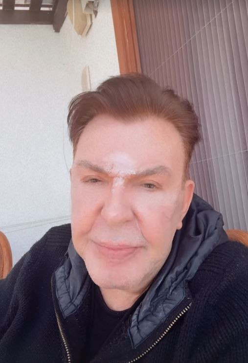 Yüz gerdirme operasyonu geçirmişti! Kuşum Aydın son halini paylaştı - Resim: 7