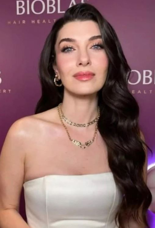 Aslıhan Güner kız kardeşleriyle poz verdi! Benzerlikleri görenleri şoke etti! "Üçüz gibiler" - Resim: 3