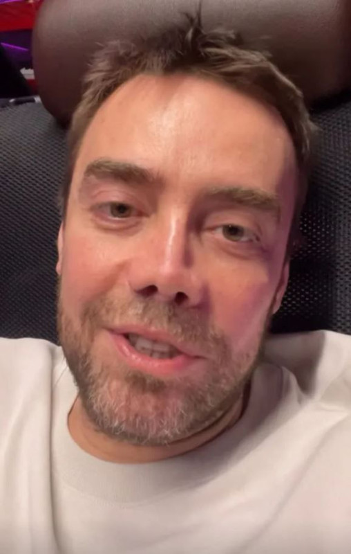 13. kez burun ameliyatı olmuştu! Murat Dalkılıç son halini paylaştı - Resim: 4