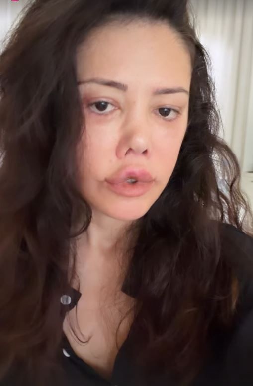 Yüz nakli operasyonu geçiren Didem Ceran'ın son hali olay oldu: "Bebeksiyim, yapay zeka değil" - Resim: 8