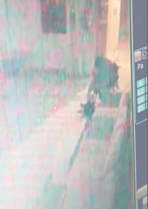 Bakımevinde dehşet: Engelli birey 5 dakika boyunca yandı - Resim: 5