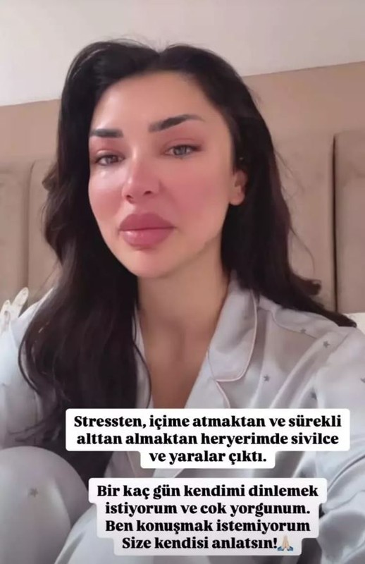9 yıl sonra barışmışlardı! Kısmet Olur Aycan Varış ile Onur Yüksel'den kötü haber! Gözyaşları içerisinde anlattı - Resim: 5