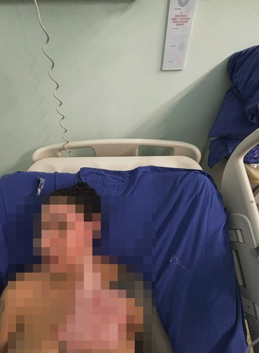 Önce çakmakla yakıldı ardından tehdit mesajları aldı: 'Kız arkadaşım sizin yüzünüzden...' - Resim: 5