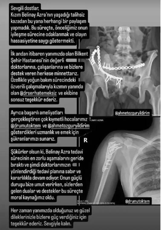 Kızı 8. kattan düşmüştü! Survivor'ın eski yarışmacısı, kızının sağlık durumunu anlattı - Resim: 3