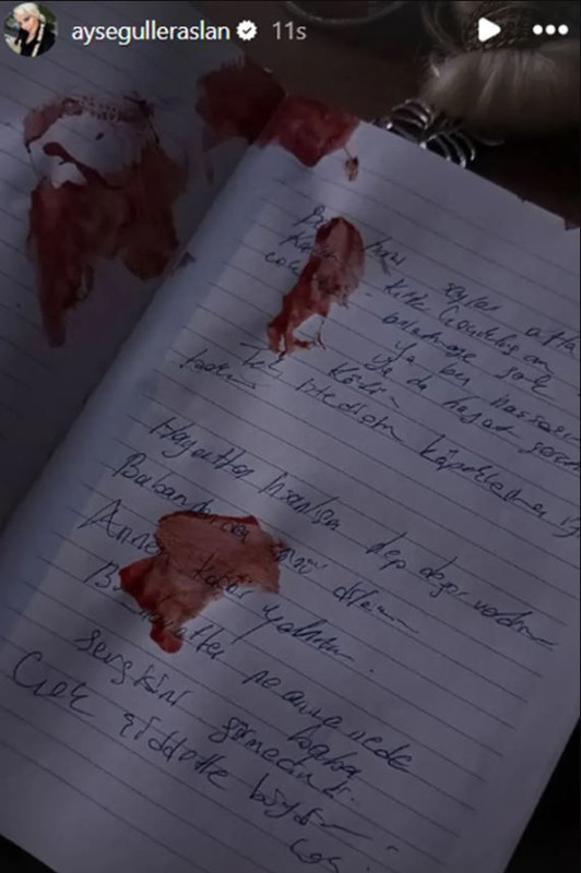 Ayşegül Eraslan'ın otopsi raporundaki gerçek ortaya çıktı! Cinayete mi kurban gitti? Arkadaşından şoke eden iddia - Resim: 4