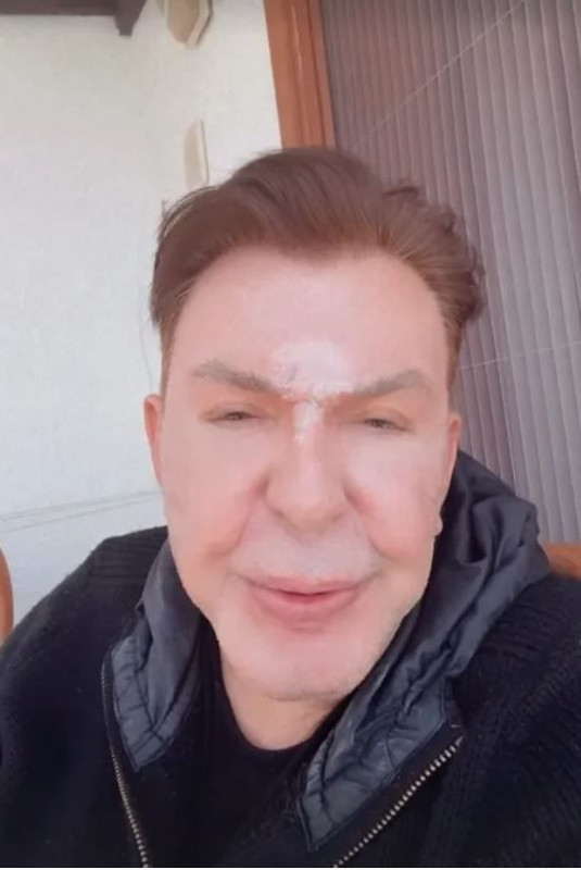 Yüz gerdirme operasyonu geçiren Kuşum Aydın eleştirilere ateş püskürdü: Utanmasalar küfür edecekler! - Resim: 5