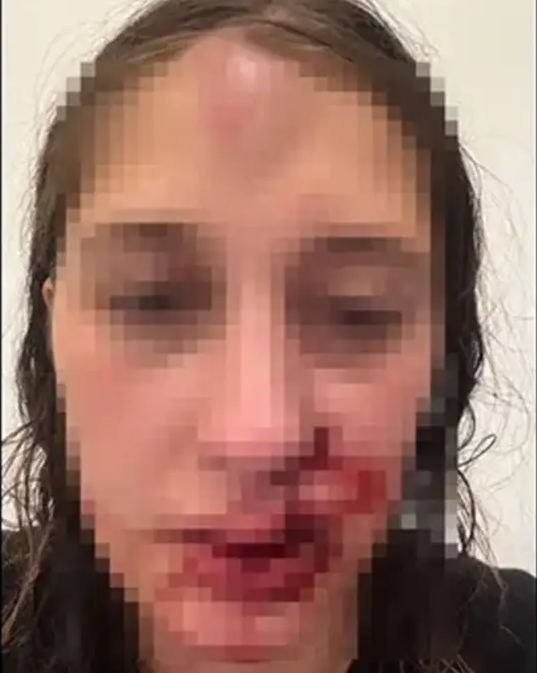 Bu görüntüler sosyal medyayı ayağa kaldırdı! Hamileyken de şiddet gördü: Genç kadının dramı yürekleri burktu - Resim : 1
