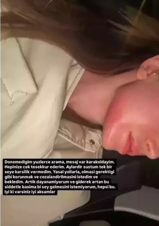Şiddet uygulayan eski sevgilisi peşini bırakmıyor! Tek tek anlattı! Sosyal medya fenomeni Danla Bilic’e ölüm tehdidi! - Resim : 1