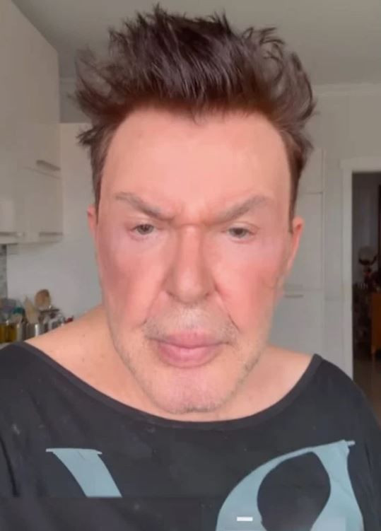 Yüz gerdirme operasyonu geçiren Kuşum Aydın eleştirilere ateş püskürdü: Utanmasalar küfür edecekler! - Resim: 6