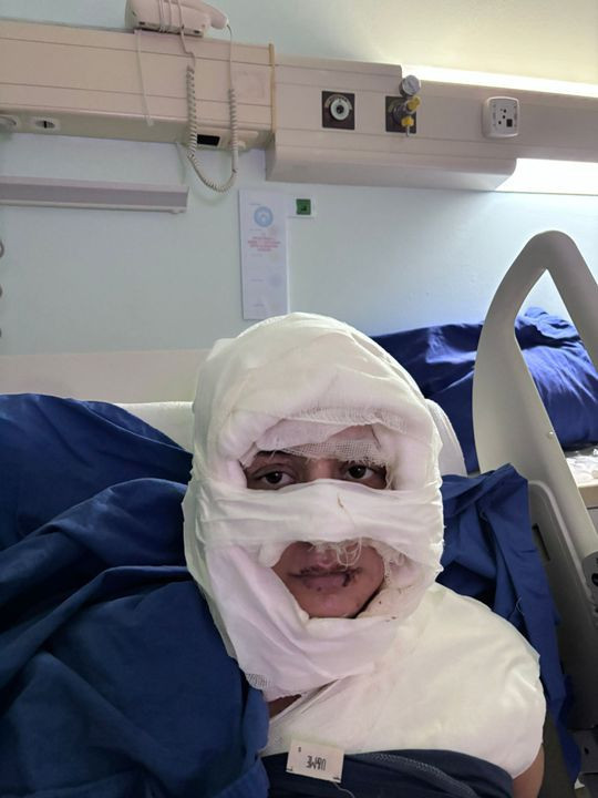 Önce çakmakla yakıldı ardından tehdit mesajları aldı: 'Kız arkadaşım sizin yüzünüzden...' - Resim: 3