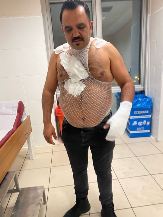 Fenomen tostçunun sıcak su deneyi felaketle bitti! Havaya attı, acı içinde kıvrandı - Resim: 3