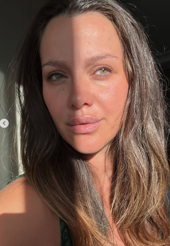 Bağdat Caddesi'nde üzerlerine motosiklet uçmuştu! İrem Helvacıoğlu ve ailesine çirkin saldırı - Resim: 10