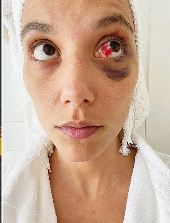 Eski sevgilisi Ozan Güven’le davalık olmuştu! Deniz Bulutsuz sessizliğini bozdu! "Cezaevine gireceği günü bekliyorum" - Resim: 4