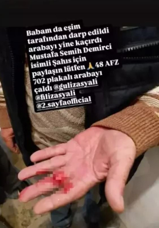 Yıldız Asyalı'dan yardım çağrısı: "Can güvenliğimiz yok!" diyerek şiddeti paylaştı - Resim: 8