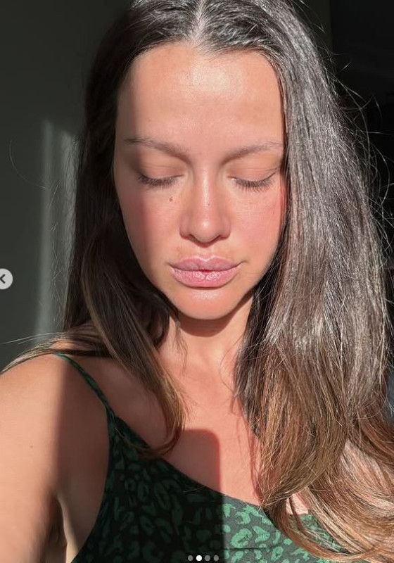 Bağdat Caddesi'nde üzerlerine motosiklet uçmuştu! İrem Helvacıoğlu ve ailesine çirkin saldırı - Resim: 8