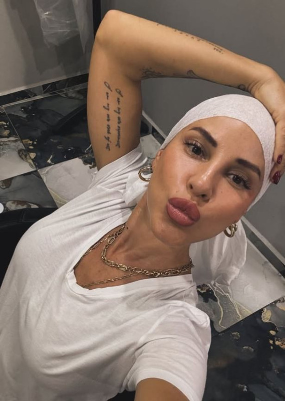 Aylardır meme kanseriyle mücadele ediyordu! Ünlü oyuncu Irmak Ünal'dan duygulandıran paylaşım - Resim: 3