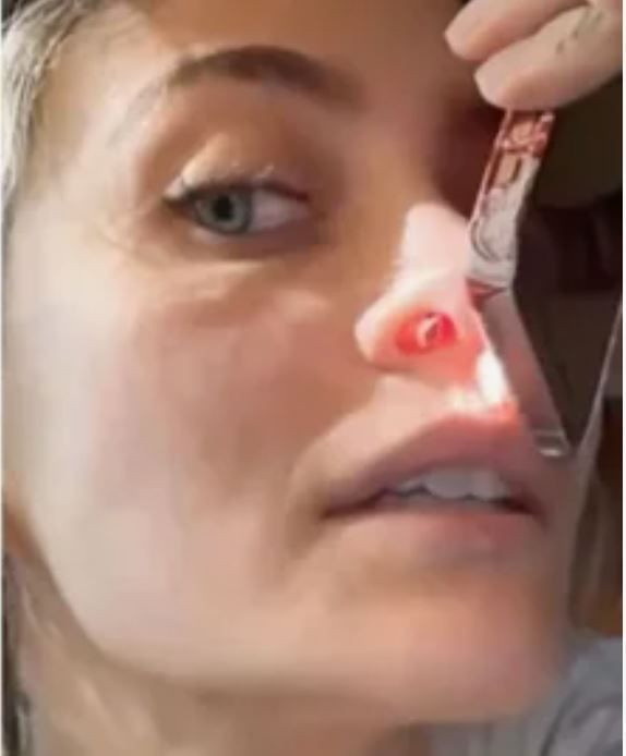 Michael Jackson'ın kızından şoke eden uyuşturucu itirafı! Burnunda açılan deliği paylaştı - Resim: 6