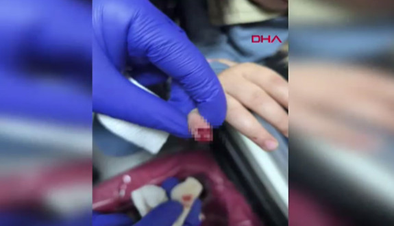 AVM'de korkunç olay! Yürüyen merdivene eli sıkışan çocuğun parmağı koptu