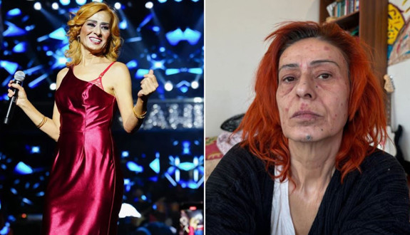 Yüzünde kimyasal yanık oluşmuştu! Yıldız Tilbe artık saçlarında 4 malzeme kullanıyor: Formülü verdi