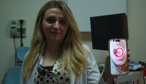 Bademcik diye gitti, doktor görünce şoke oldu! Çocuğun boğazından sülük çıktı