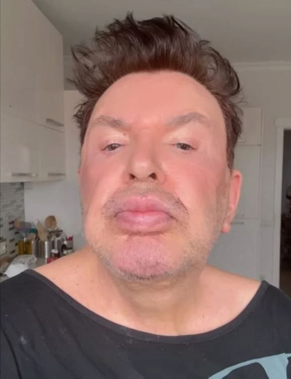 Yüz gerdirme operasyonu geçiren Kuşum Aydın eleştirilere ateş püskürdü: Utanmasalar küfür edecekler! - Resim: 4